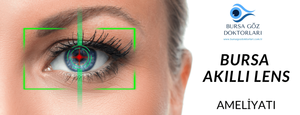 Bursa Akıllı Lens Ameliyatı Bursa akıllı lens ameliyatı